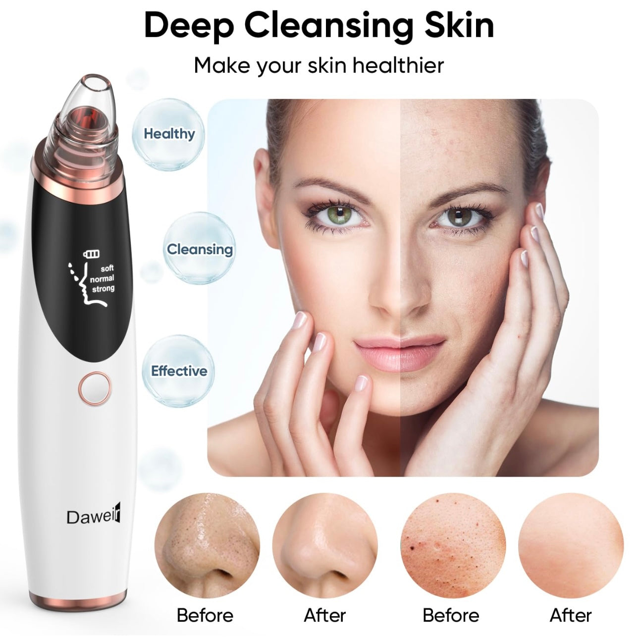 Electric Blackhead Remover Pore Vacuum.
