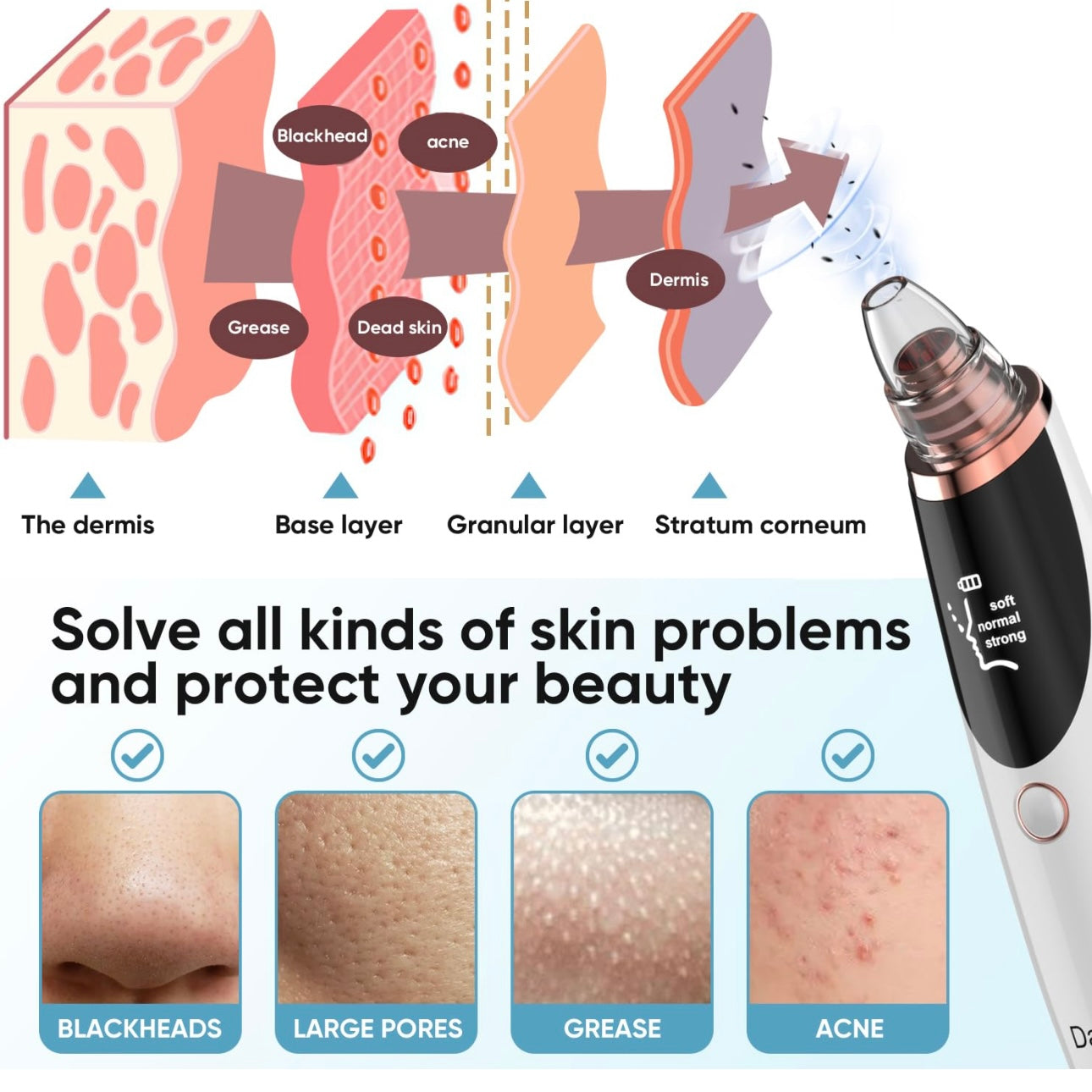 Electric Blackhead Remover Pore Vacuum.