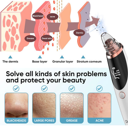 Electric Blackhead Remover Pore Vacuum.